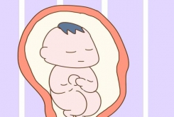 為什么剖腹產(chǎn)出生的孩子更容易感統(tǒng)失調